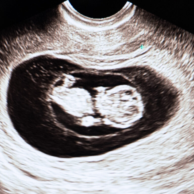 Foster Scanning i uge 14